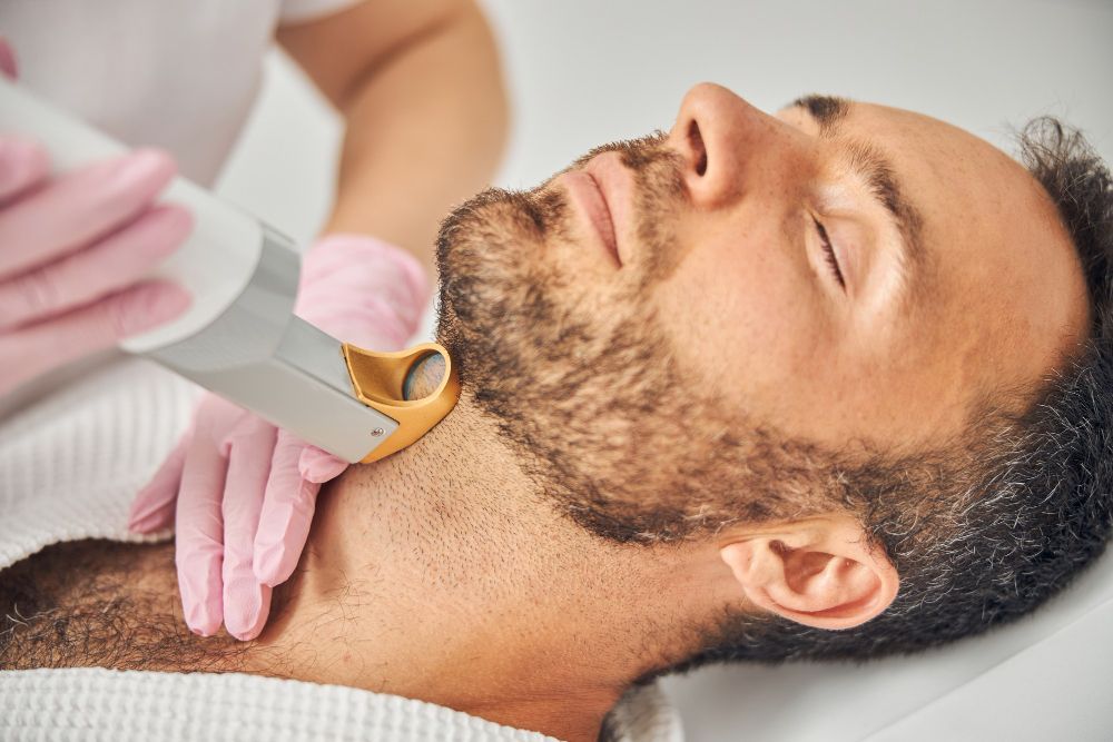 Men’s Grooming Guide: Laser Hair Removal in the Philippines for Facial Hair